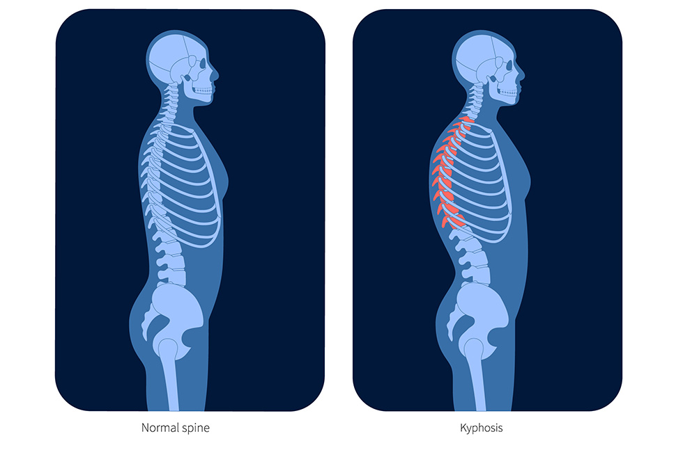 durere în apropierea omoplatului drept în apropierea coloanei vertebrale